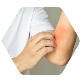 Best doctor for psoriasis in hyderabad best doctor for psoriasis treatment in hyderabad best hospital for psoriasis treatment in hyderabad best psoriasis treatment in hyderabad cupping for psoriasis hijama for psoriasis hijama for scalp psoriasis hijama psoriasis permanent treatment for psoriasis in hyderabad psoriasis and cupping therapy psoriasis best treatment in hyderabad psoriasis hospital in banjara hills hyderabad psoriasis permanent cure in hyderabad psoriasis specialist hyderabad psoriasis specialist in hyderabad psoriasis treatment hospitals in hyderabad psoriasis treatment in hyderabad scalp psoriasis treatment in hyderabad